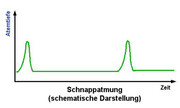 [Bild: kurs31_atmung_atemrhythmus_schnappatmung.jpg]